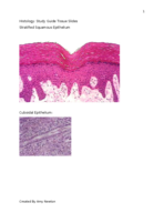 What is a stratified squamous epithelium?