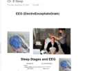 Ch. 8 & 15, Sleep and Affective Disorders
