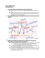 ECG